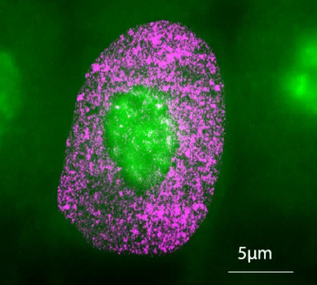 AINU can detect cellular changes as small as 20 nm—5,000 times smaller than the width of a human hair.